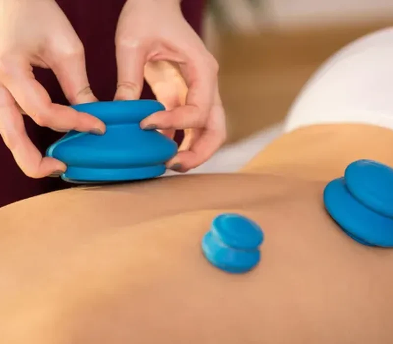 Cupping therapy session for soft-tissue recovery