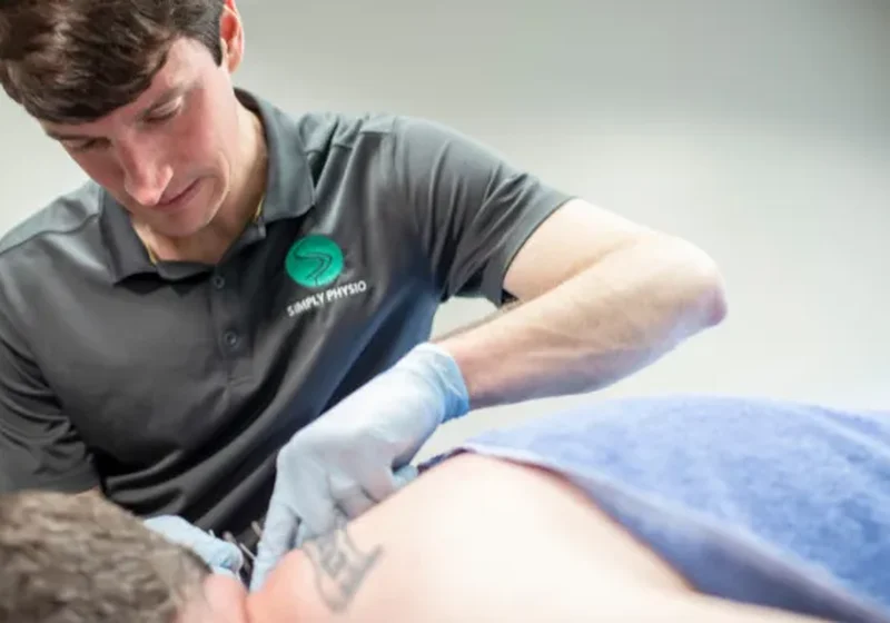 Dry Needling at Simply Physio