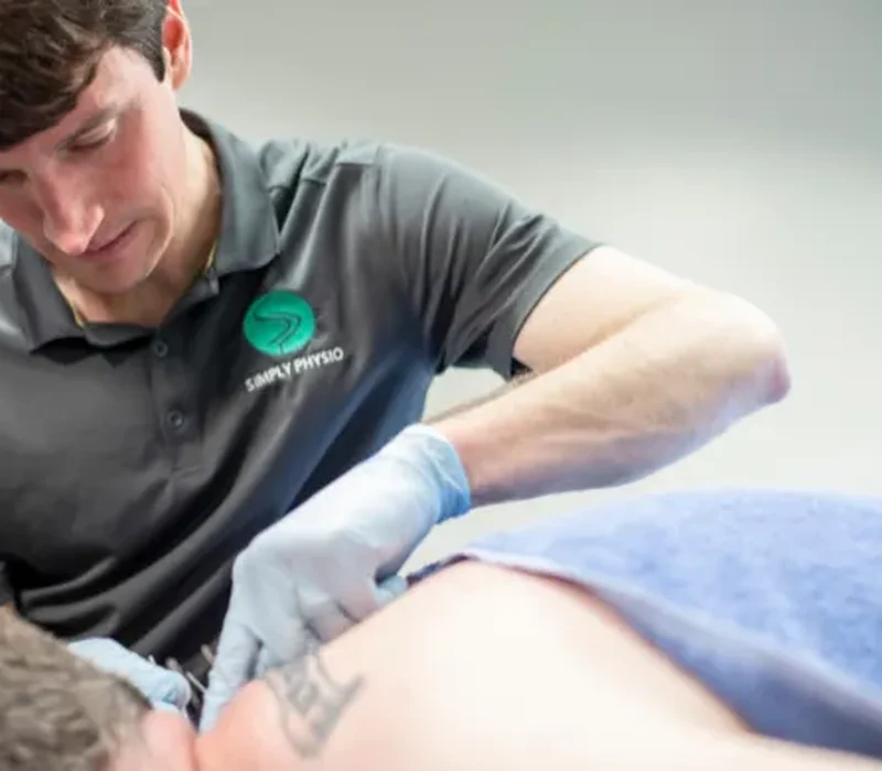 Clinician performing dry needling trigger-point treatment