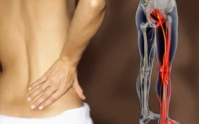 Sciatica and 5 Reasons Why Your Back is Flaring Up