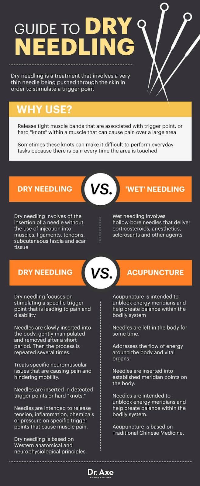 What is better than dry needling?