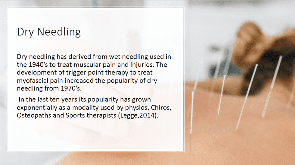 How long dry needling lasts? Simply Physio