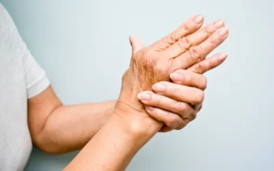 How Physical Therapy Can Help Manage Arthritis Symptoms Naturally