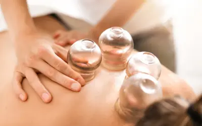 The Dangers of Cupping: What You Need to Know Before You Try It