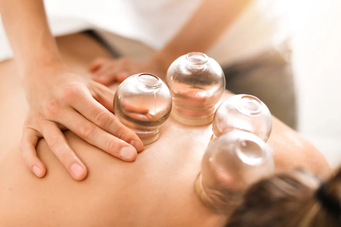 The Dangers of Cupping