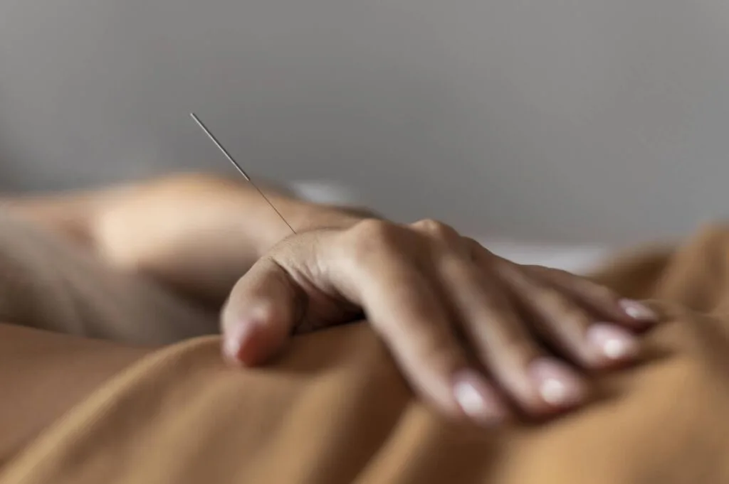What Happens When Dry Needling Hits a Nerve What Happens When Dry Needling Hits a Nerve
