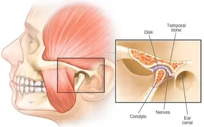 What Causes TMJ Pain? The Five Drivers Behind Almost Every Case